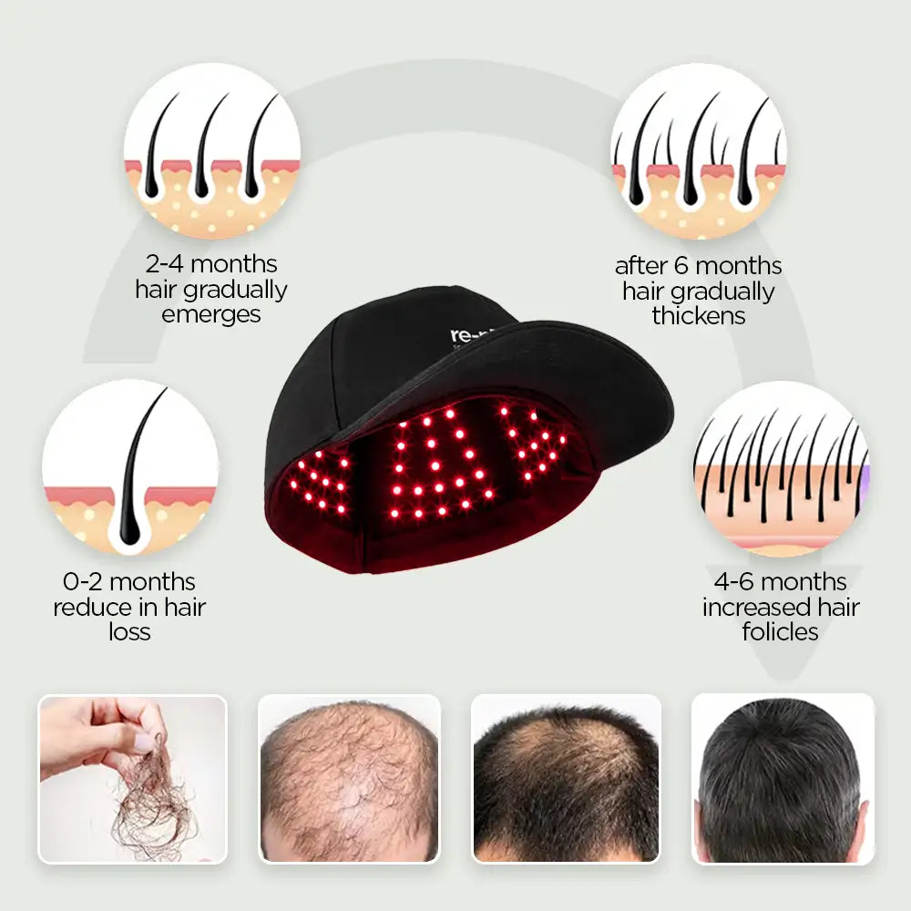 GORELIT Red Light Therapy Cap